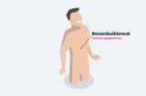 Bovenbuikbreukoperatie