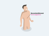Bovenbuikbreukoperatie