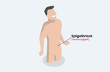 Spigelbreuk