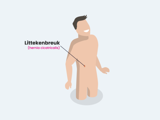 Littekenbreuk