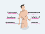Buikwandbreukoperatie