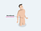 Navelbreuk